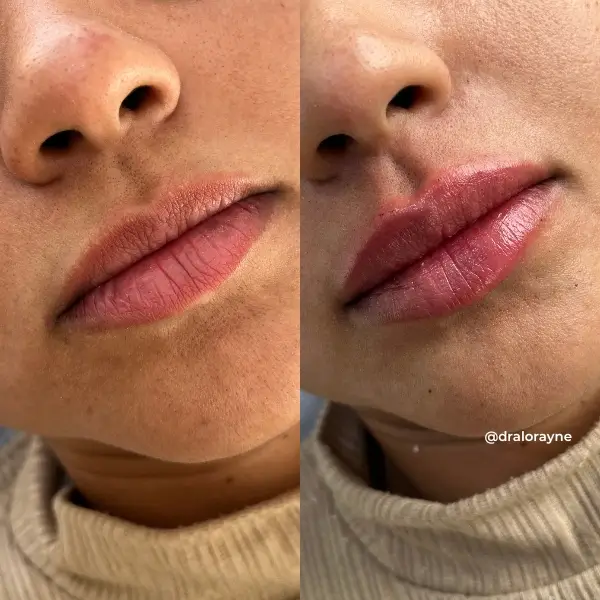 Resultado de realce facial natural